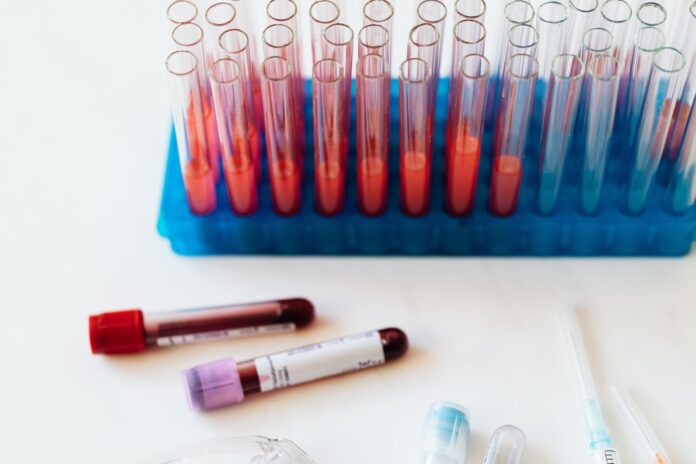 talassemia